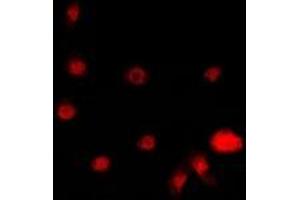 Immunofluorescent analysis of STK19 staining in A549 cells. (STK19 抗体)