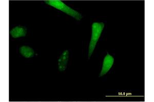 Immunofluorescence of monoclonal antibody to SIK1 on HeLa cell. (SIK1 抗体  (AA 1-100))