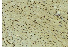 ABIN6277618 at 1/100 staining Mouse muscle tissue by IHC-P. (DNMT1 抗体  (Internal Region))