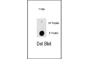 Dot blot analysis of anti-ILK-p Pab (R) on nitrocellulose membrane. (ILK 抗体  (pThr173))