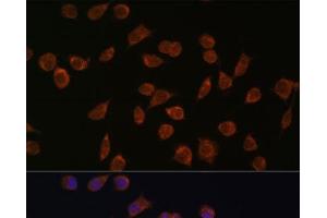 Immunofluorescence analysis of L929 cells using ACSS1 Polyclonal Antibody at dilution of 1:100. (ACSS1 抗体)