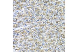 Immunohistochemistry of paraffin-embedded mouse stomach using STXBP2 antibody (ABIN5975753) at dilution of 1/100 (40x lens). (STXBP2 抗体)