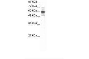 Image no. 1 for anti-Zinc Finger Protein 276 (ZNF276) (AA 284-333) antibody (ABIN6736062) (ZNF276 抗体  (AA 284-333))