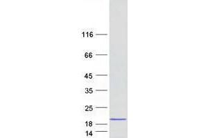 Validation with Western Blot