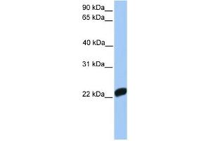 Factor X antibody used at 1 ug/ml to detect target protein.