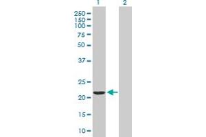 Western Blot analysis of VBP1 expression in transfected 293T cell line by VBP1 MaxPab polyclonal antibody. (VBP1 抗体  (AA 1-197))