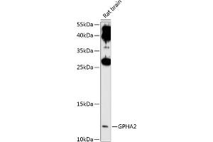 Western blot analysis of extracts of rat brain, using GPH antibody (ABIN6132023, ABIN6141322, ABIN6141323 and ABIN6214909) at 1:1000 dilution. (GPHa2 抗体  (AA 24-129))