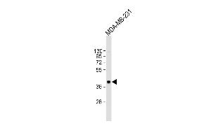 Anti-CYR61 Antibody (Center) at 1:2000 dilution + MDA-MB-231 whole cell lysate Lysates/proteins at 20 μg per lane. (CYR61 抗体  (AA 143-174))