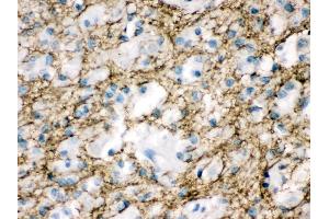 Anti- Munc18-1 Picoband antibody, IHC(P) IHC(P): Human Glioma Tissue (STXBP1 抗体  (N-Term))