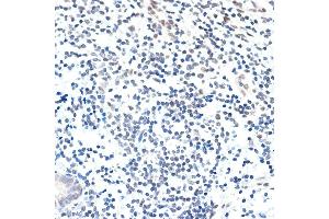 Immunohistochemistry of paraffin-embedded human appendix using P Rabbit mAb (ABIN7269152) at dilution of 1:100 (40x lens). (PAF1/PD2 抗体)