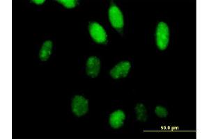 Immunofluorescence of purified MaxPab antibody to TCEA2 on HeLa cell. (TCEA2 抗体  (AA 1-299))