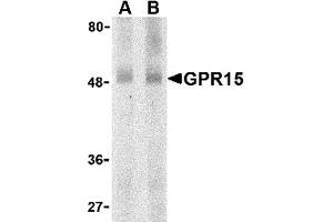 Western Blotting (WB) image for anti-G Protein-Coupled Receptor 15 (GPR15) (N-Term) antibody (ABIN1031395) (GPR15 抗体  (N-Term))