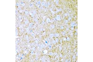 Immunohistochemistry of paraffin-embedded rat brain using WNT2 antibody (ABIN5973475) at dilution of 1/200 (40x lens). (WNT2 抗体)