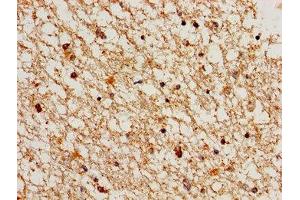 Immunohistochemistry of paraffin-embedded human brain tissue using ABIN7148834 at dilution of 1:100 (Cyclin A1 抗体  (AA 1-152))