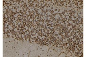 ABIN6276817 at 1/100 staining Mouse brain tissue by IHC-P. (AKR1B1 抗体  (C-Term))
