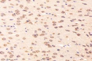 Immunohistochemistry analysis of paraffin-embedded mouse striatum using,RRAGB (ABIN7075379) at dilution of 1: 4000 (RRAGB 抗体)