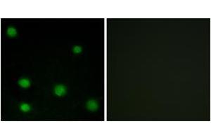 Immunofluorescence analysis of COS7 cells, using RBM6 Antibody. (RBM6 抗体  (AA 991-1040))