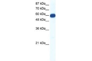 SLC18A1 antibody used at 0. (SLC18A1 抗体  (N-Term))
