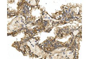 IHC analysis of GRB14 using anti-GRB14 antibody (ABIN7599149). (GRB14 抗体  (AA 1-246))