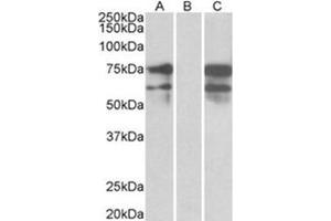 HEK293 lysate (10 µg protein in RIPA buffer) overexpressing Human NRXN1 with DYKDDDDK tag probed with ABIN783000 (0. (Neurexin 1 抗体  (C-Term))