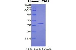SDS-PAGE of Protein Standard from the Kit (Highly purified E.