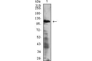 Western blot analysis using CD49D mAb against HEK293 (1) and CD49D (AA: extra 833-977))-hIgGFc transfected HEK293 (2) cell lysate. (ITGA4 抗体  (AA 833-977))