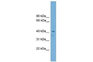 Acd antibody used at 2. (ACD 抗体  (C-Term))