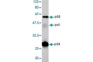 Detection of HIV-1 p24 and precursor proteins p55 and p41 by Western blotting using the HIV-1 Gag p24 polyclonal antibody  . (HIV-1 p24 抗体)