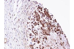 Immunohistochemistry (IHC) image for anti-Triosephosphate Isomerase 1 (TPI1) (C-Term) antibody (ABIN2855867)