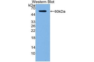Western Blotting (WB) image for anti-Acid Phosphatase 5, Tartrate Resistant (ACP5) (AA 79-318) antibody (ABIN1857873) (ACP5 抗体  (AA 79-318))