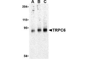 Western blot analysis of TRPC6 in mouse lung tissue lysate with this product at (A) 0. (TRPC6 抗体  (C-Term))