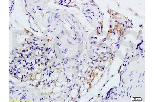 Immunohistochemistry (IHC) image for anti-Interleukin 1 Receptor, Type I (IL1R1) (AA 481-569) antibody (ABIN747743)