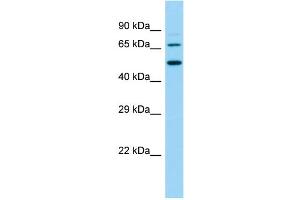 Host:  Rabbit  Target Name:  Slc9a8  Sample Type:  Rat Small Intestine lysates  Antibody Dilution:  1. (NHE8 抗体  (N-Term))