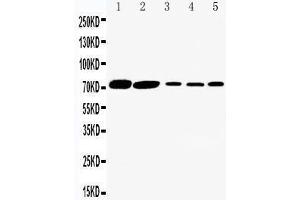 Anti-SGLT1 antibody, Western blotting Lane 1: Rat Kidney Tissue Lysate Lane 2: Rat Heart Tissue Lysate Lane 3: HELA Cell Lysate Lane 4: SW620 Cell Lysate Lane 5: COLO320 Cell Lysate (SLC5A1 抗体  (C-Term))