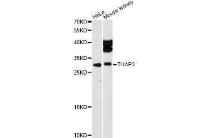 Western blot analysis of extracts of various cell lines, using THAP3 antibody (ABIN6293620) at 1:1000 dilution. (THAP3 抗体)