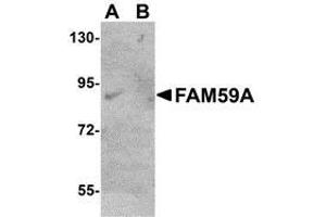 Western blot analysis of FAM59A in rat liver tissue lysate with AP30330PU-N FAM59A antibody at (A) 1 and (B) 2 μg/ml. (FAM59A 抗体  (C-Term))
