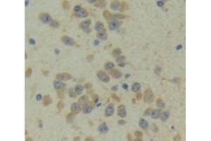 Used in DAB staining on fromalin fixed paraffin- embedded Kidney tissue (CITED1 抗体  (AA 1-203))