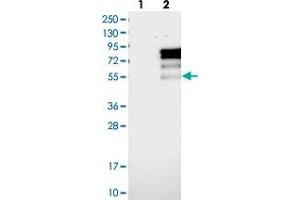 Western blot analysis of Lane 1: Negative control (vector only transfected HEK293T lysate), Lane 2: Over-expression Lysate (Co-expressed with a C-terminal myc-DDK tag (~3. (PRCC 抗体)