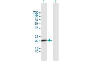 Western Blot analysis of RHOQ expression in transfected 293T cell line by RHOQ MaxPab polyclonal antibody. (RHOQ 抗体  (AA 1-205))