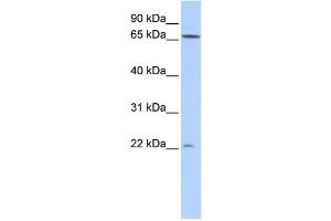 Western Blotting (WB) image for anti-DIRAS Family, GTP-Binding RAS-Like 1 (DIRAS1) antibody (ABIN2459582) (DIRAS1 抗体)