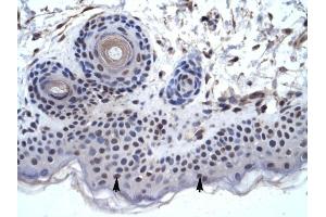 ZNF660 antibody was used for immunohistochemistry at a concentration of 4-8 ug/ml to stain Squamous epithelial cells (arrows) in Human Skin. (ZNF660 抗体  (C-Term))