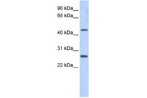 PRAMEF10 antibody used at 1 ug/ml to detect target protein. (PRAMEF10 抗体  (Middle Region))