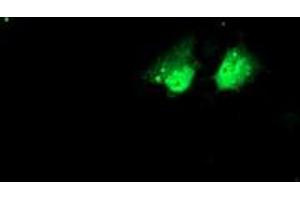 Anti-NHEJ1 mouse monoclonal antibody (ABIN2453926) immunofluorescent staining of COS7 cells transiently transfected by pCMV6-ENTRY NHEJ1 (RC203393). (NHEJ1 抗体)