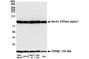 Western Blotting (WB) image for anti-alpha 1 Sodium Potassium Atpase antibody (ABIN7455086) (alpha 1 Sodium Potassium Atpase 抗体)