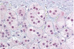 Immunohistochemistry with Adrenal tissue at an antibody concentration of 5µg/ml using anti-NR4A1 antibody (ARP45604_P050) (NR4A1 抗体  (Middle Region))
