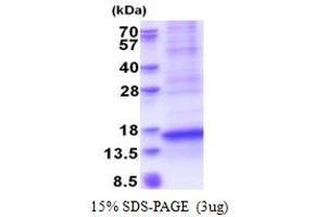 SDS-PAGE (SDS) image for Chemokine (C-X-C Motif) Ligand 17 (CXCL17) (AA 22-119) protein (His tag) (ABIN5853587) (CXCL17 Protein (AA 22-119) (His tag))