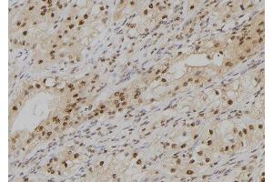 ABIN6279360 at 1/100 staining Human kidney tissue by IHC-P. (POLD4 抗体  (Internal Region))