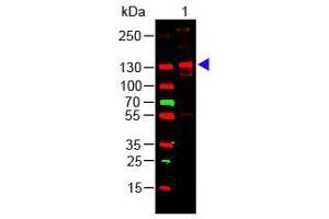 Western Blotting (WB) image for anti-Collagen, Type III, alpha 1 (COL3A1) antibody (ABIN5596829)