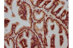 Immunohistochemistry (IHC) image for anti-Cyclin F (CCNF) (AA 248-400) antibody (ABIN7152402)