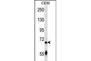 SLC27A3 Antibody (N-term) (ABIN657380 and ABIN2846425) western blot analysis in CEM cell line lysates (35 μg/lane). (SLC27A3 抗体  (N-Term))